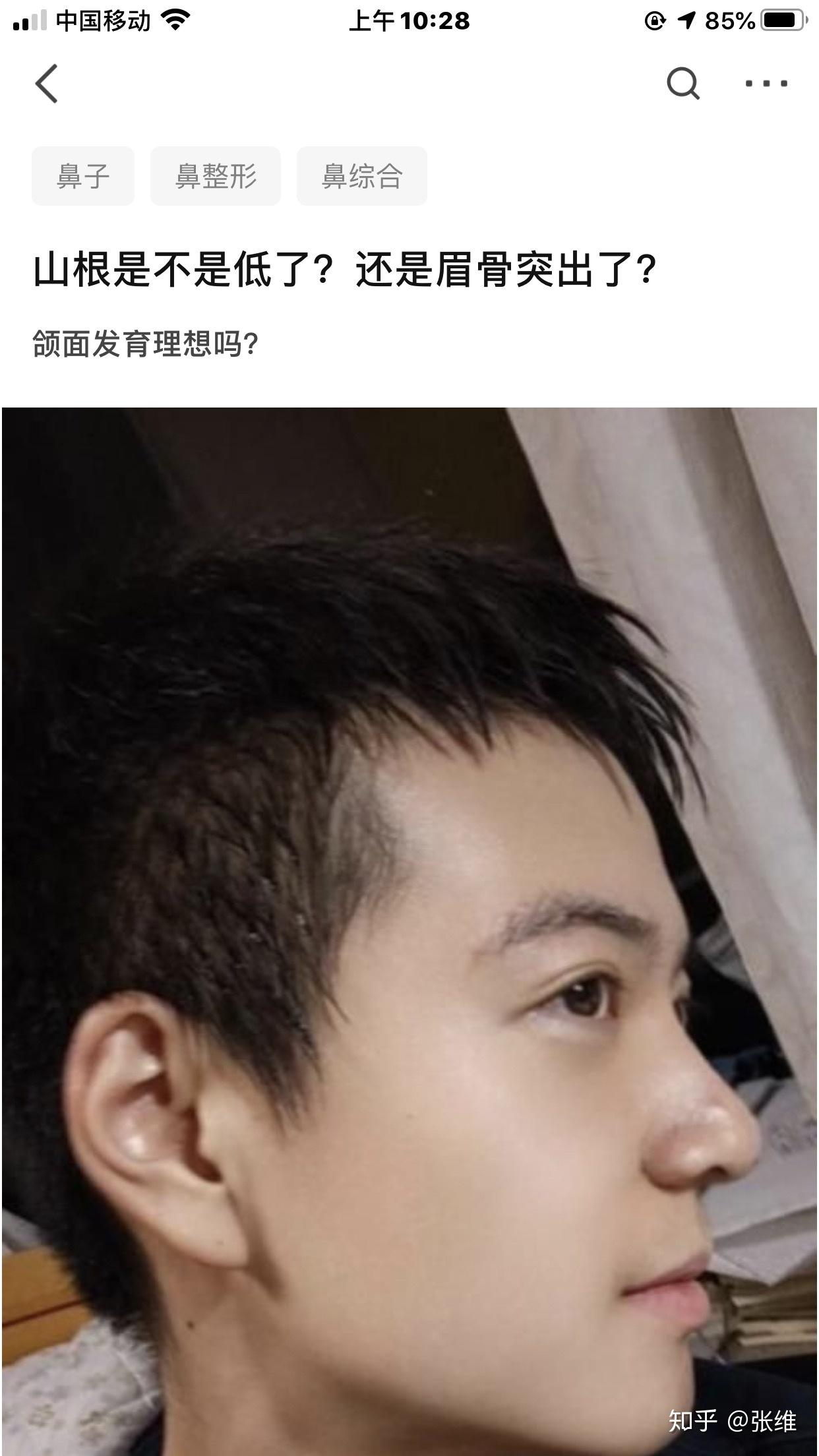 如何判断山根低还是眉骨高呢? - 知乎
