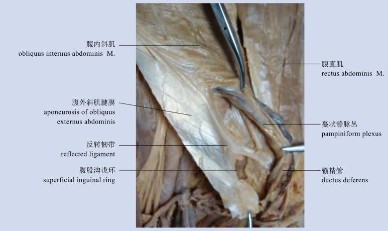 蔓状静脉丛图片