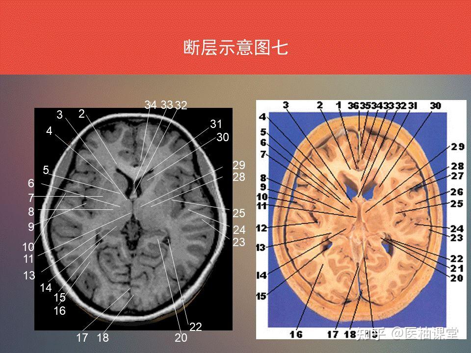 脑功能区及解剖学定位 - 知乎