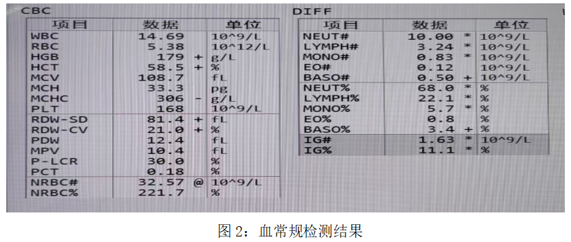 一例罕见的有核红细胞升高的病例 - 知乎