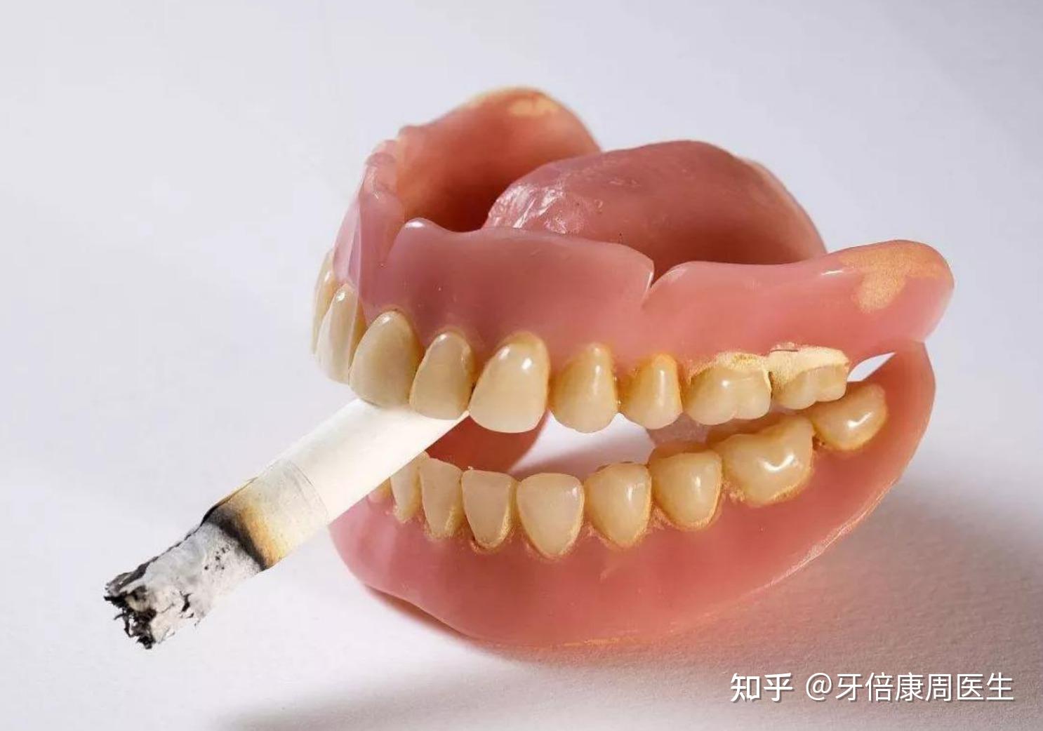 拔牙后能抽烟吗 zhuanlan.zhihu.com