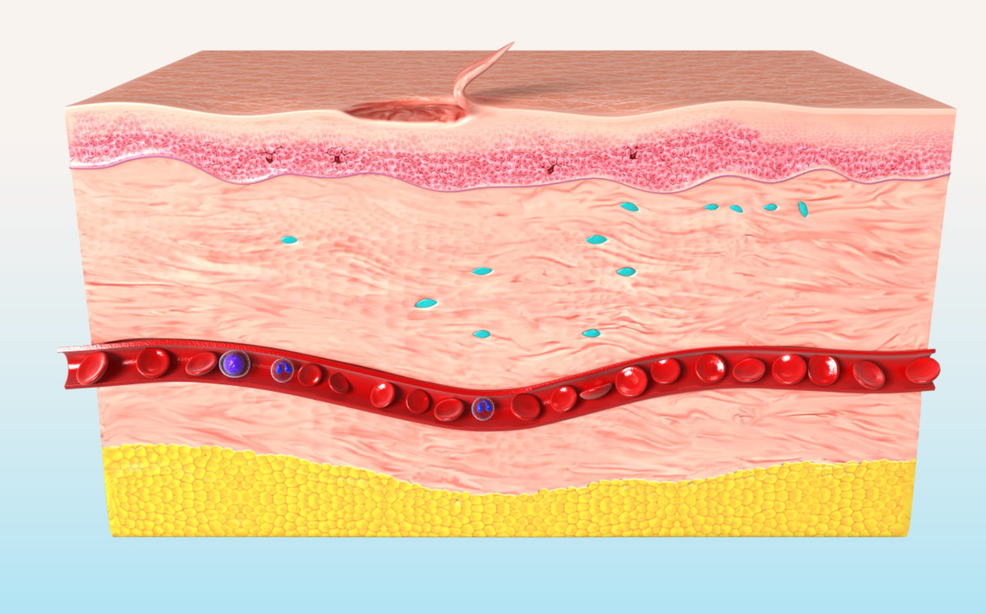 干细胞让皮肤创伤快速愈合不留疤