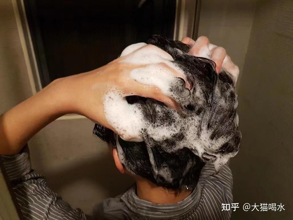 头油,头屑严重的脱发少女,怎样选择洗发水等头部洗护!