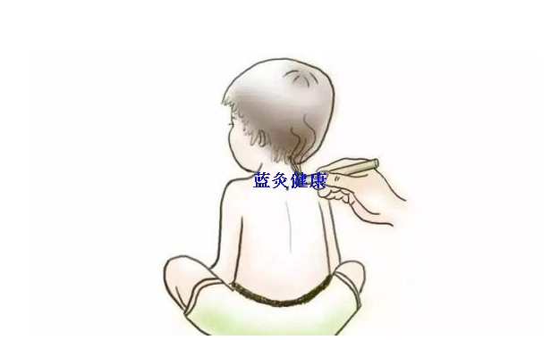 小孩子久咳能艾灸吗?小孩子久咳艾灸哪里?