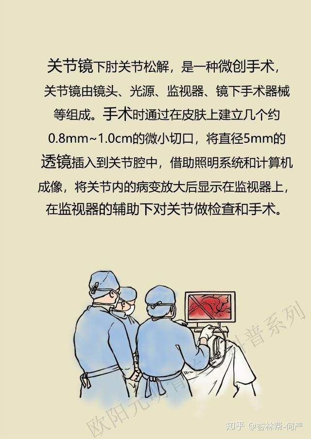 肘关节僵硬:关节镜技术