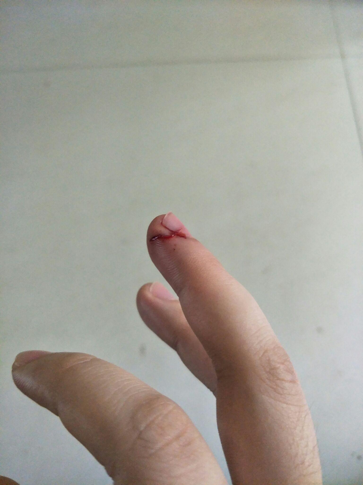 切菜时切到手是一种什么样的体验