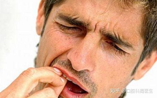 大家从小常常听到"牙疼不是病,痛起来要人命!",并不是夸张的形容.