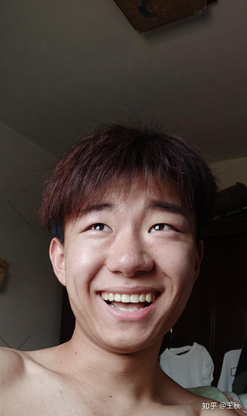 20岁男生长得奇怪,笑起来很猥琐很可怕,怎么救? (多图)