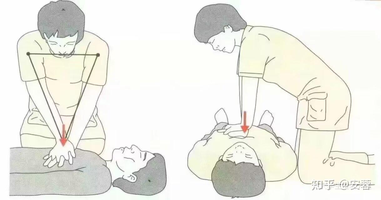 【CPR】心肺复苏国际标准操作流程 - 知乎