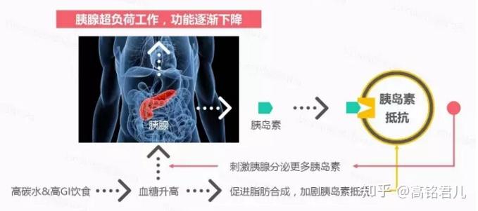 如何改善和逆转胰岛素抵抗了解2型糖尿病的发病机制