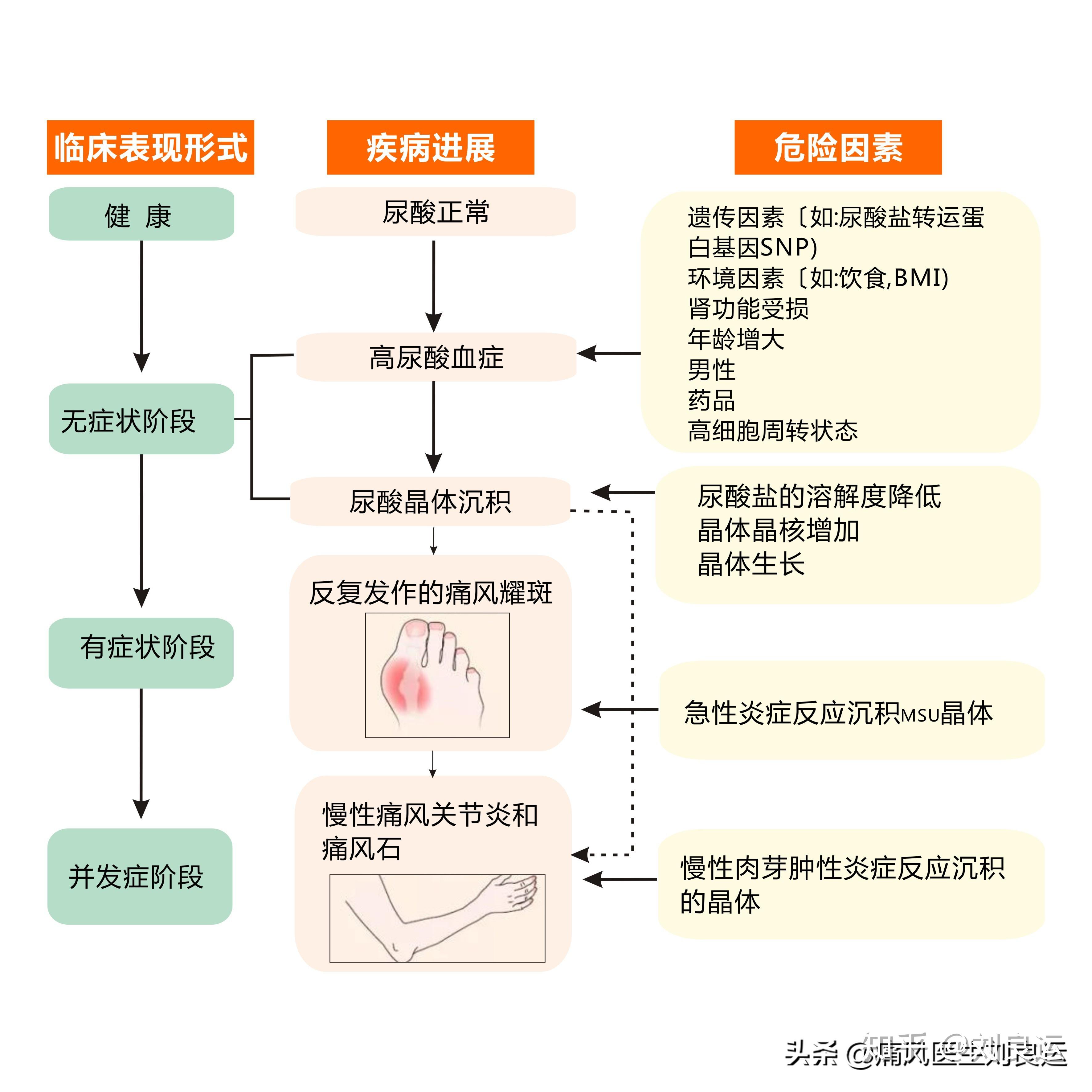 誤區八:尿酸達標就可以停藥?