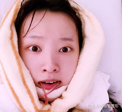 换头手术真的存在吗 v2-060d6fa7650e683451aa6e884b05f291_r.jpg