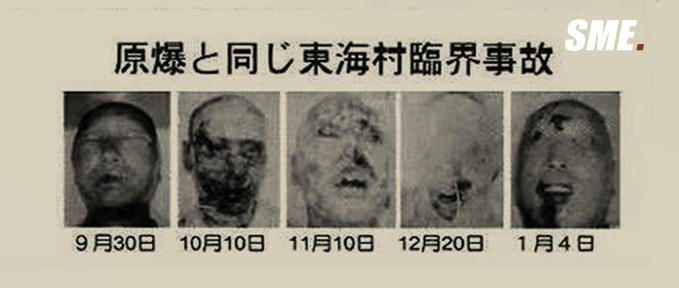 如果不害怕,那恐怕是不甚了解核辐射对于人的摧残能可