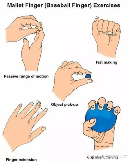 手指康复训练最佳方法图片