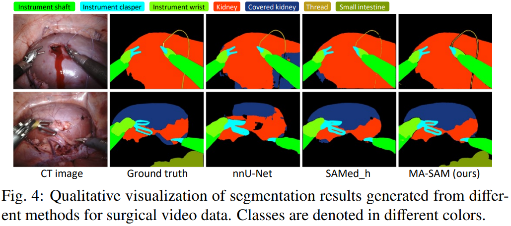 Master Sam Multi Factor 【arXiv 2309】MA-SAM:适用于三维医学图像分割的模态不可知SAM适应方法(MA-SAM) - 知乎