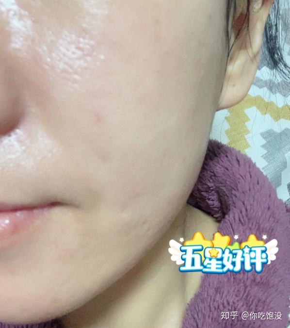 脸怎么洗才能越来越好 v2-067bd93017e81112765c8b079c157ac5_r.jpg