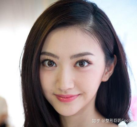 都是割的欧式双眼皮张馨予就比景甜自然亚洲人究竟适不适合欧式大双