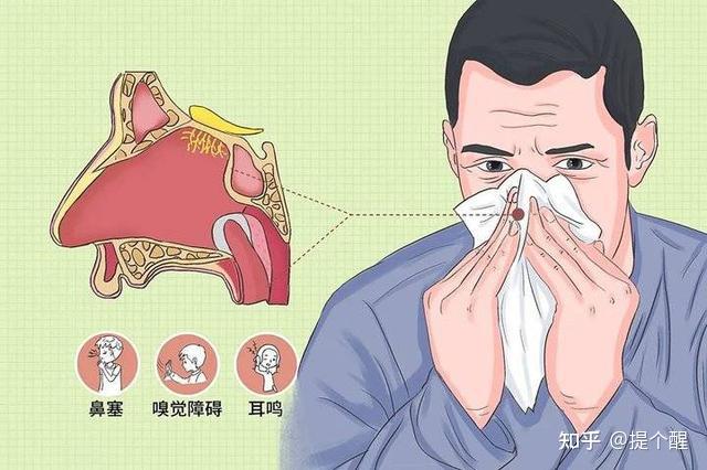 小心,这些颜色的鼻涕是在跟你求救,一定要看懂! - 知乎