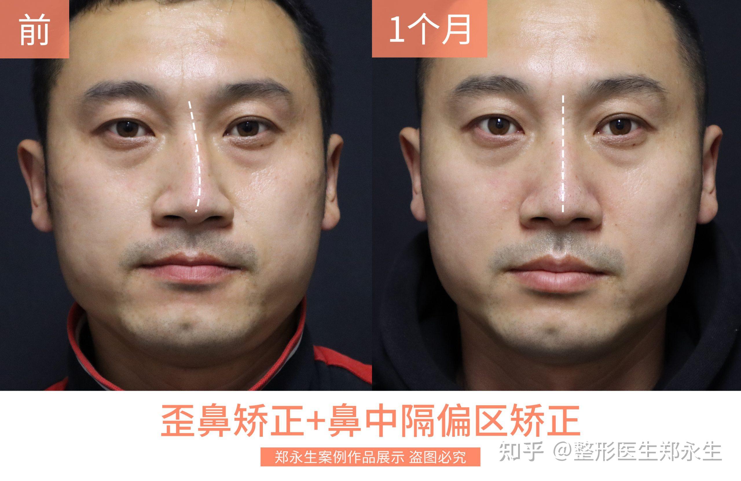 郑永生主任个人介绍及部分案例展示