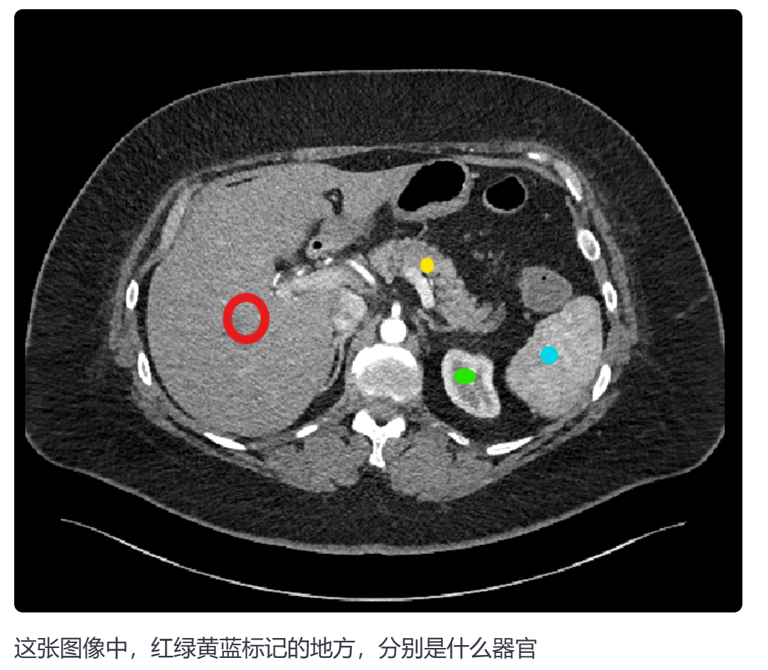 GPT-4V 医疗场景初探- 知乎