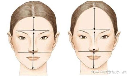 发际线调整的误区,发际线调整设计的区别 - 知乎