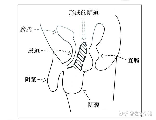 性别认同障碍的基础与临床 12 外科 手术 疗法 知乎