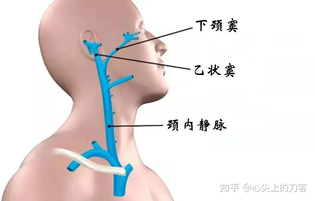 乙状窦解剖图片