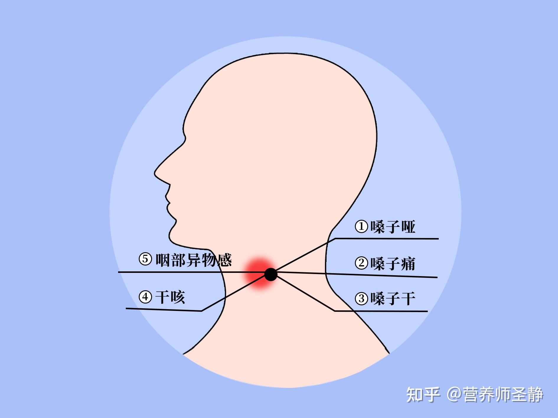 正确区分支气管炎和咽炎,知道这一点就够了