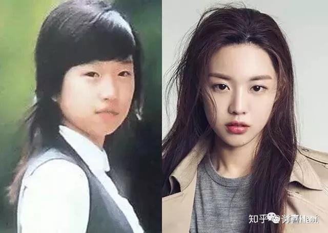 整形模板高允真：电视里的路人，论皮肉平整的重要性 - 知乎