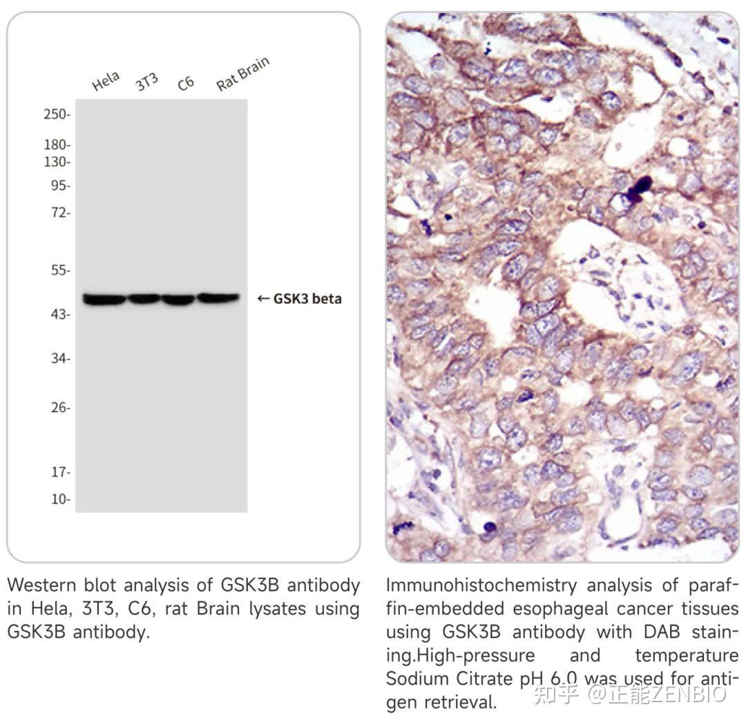 【研究专题】细胞信号传导的关键角色—Wnt通路 - 知乎