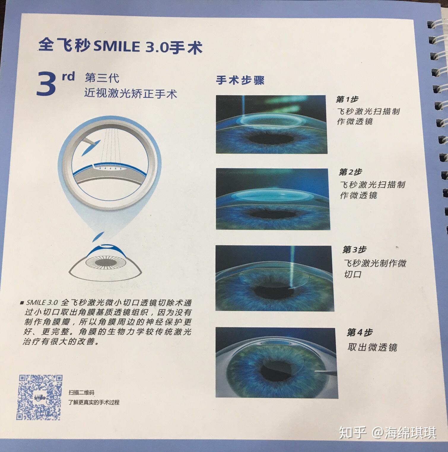 南京鼓楼医院成功开展全飞秒激光近视眼手术