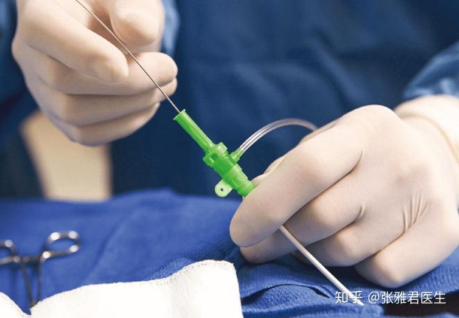 心导管简介 - 知乎