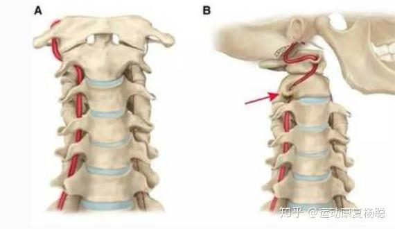 头晕 目眩 睡眠不实 是颈椎惹的祸 怎么康复了解一下 知乎