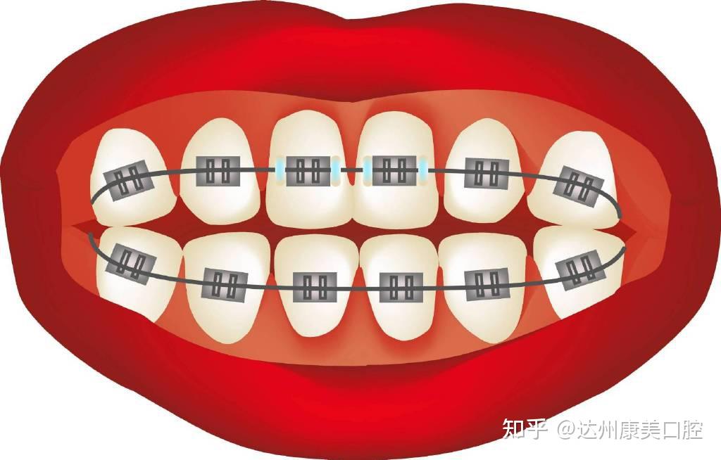 牙齿脱矿是什么原因?这种情况对我们牙齿影响大吗? - 知乎