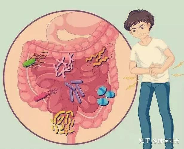 (2) 息肉症:息肉變性是目前醫學界普遍認為最可能導致大腸癌的原因,其