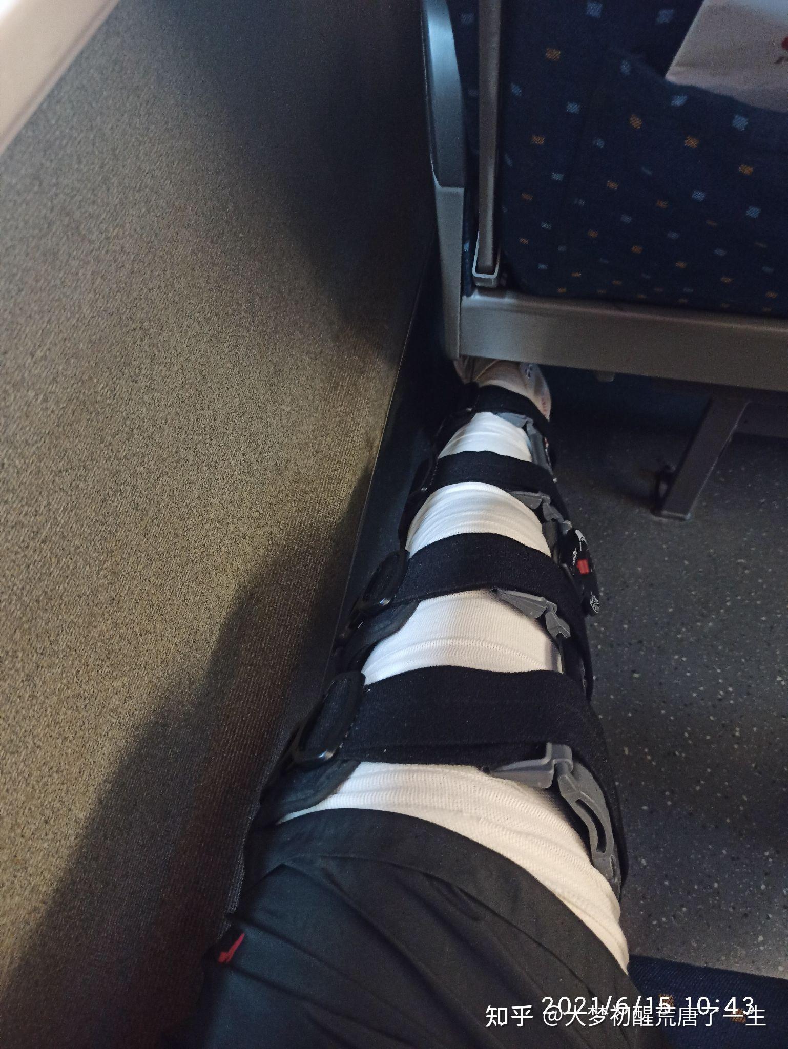 前叉韧带断裂 带给我的. .体验吧