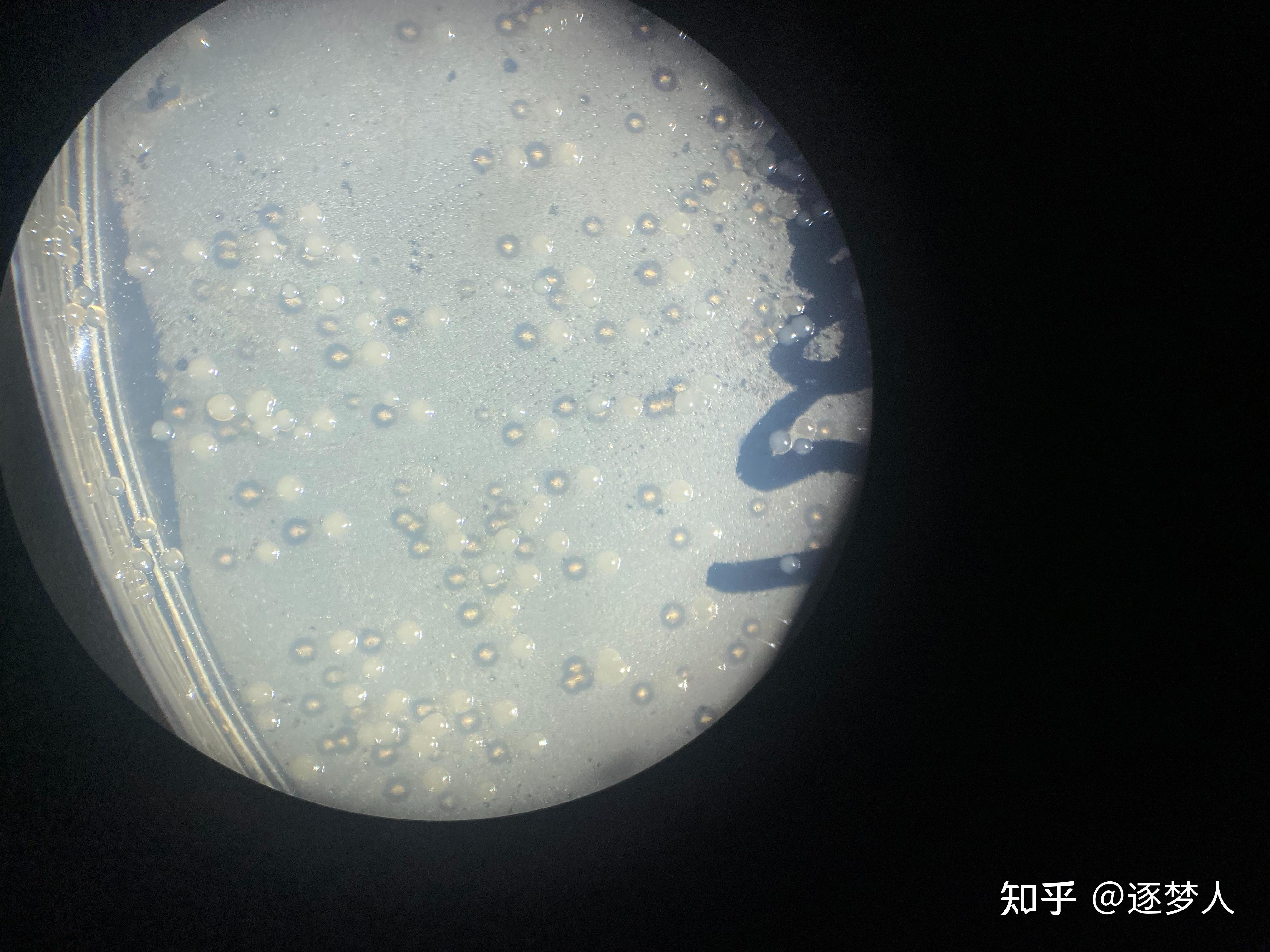 质粒转化,公司测序没结果,给答复说摇菌正常,但跑胶未检测DNA条带。 - 知乎