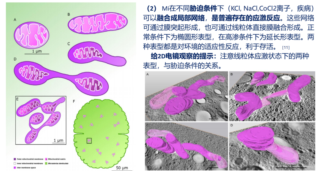 微亚实验室 | 李伯勤:医学电镜观察问题简析 IV——培养细胞TEM观察 - 知乎