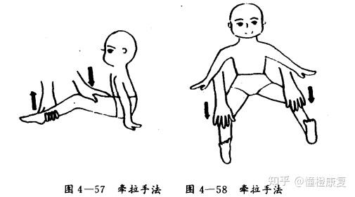 儿童膝关节呈屈曲位康复训练方法