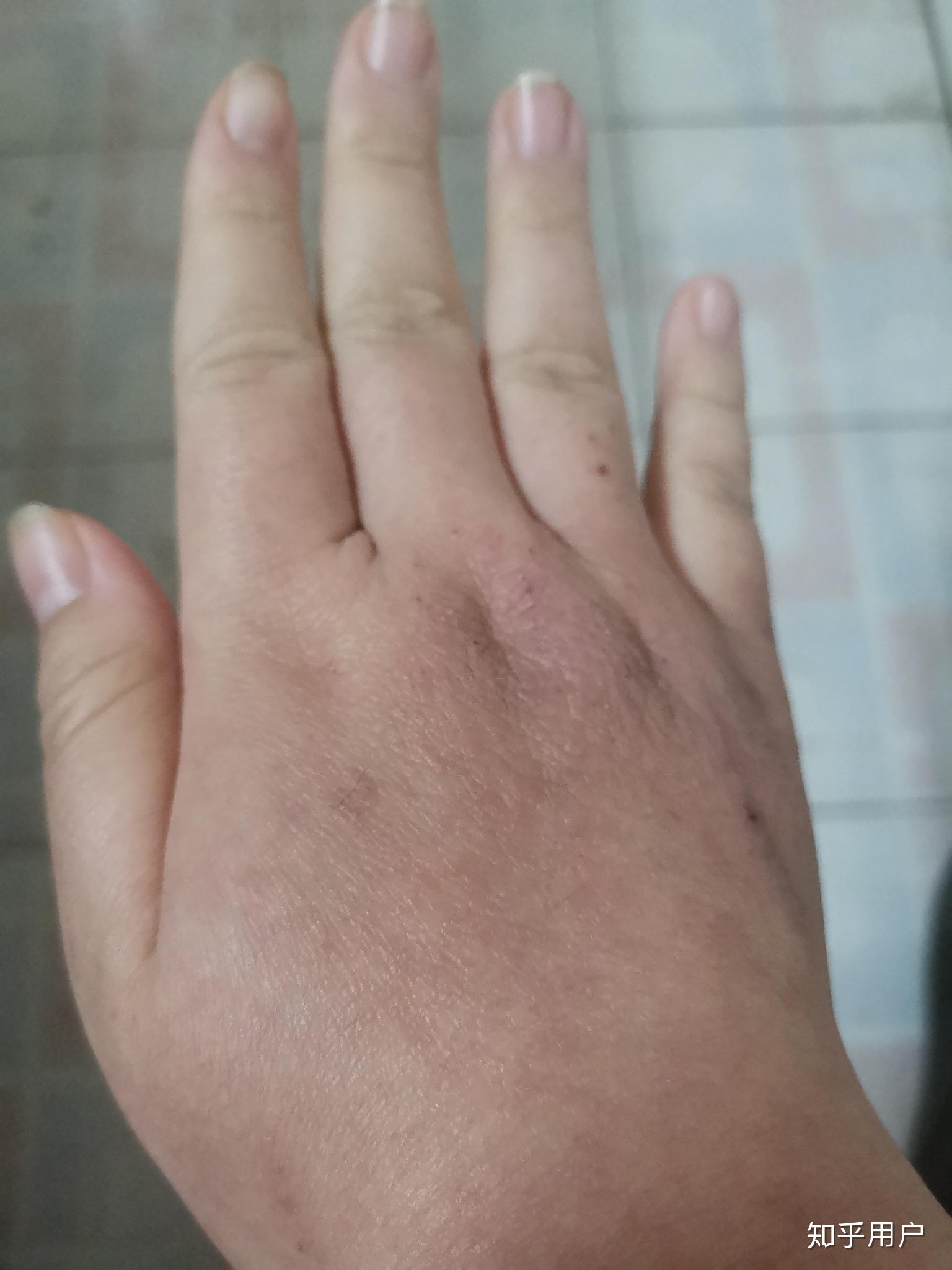 胖胖的男生拥有一双小胖手是什么体验