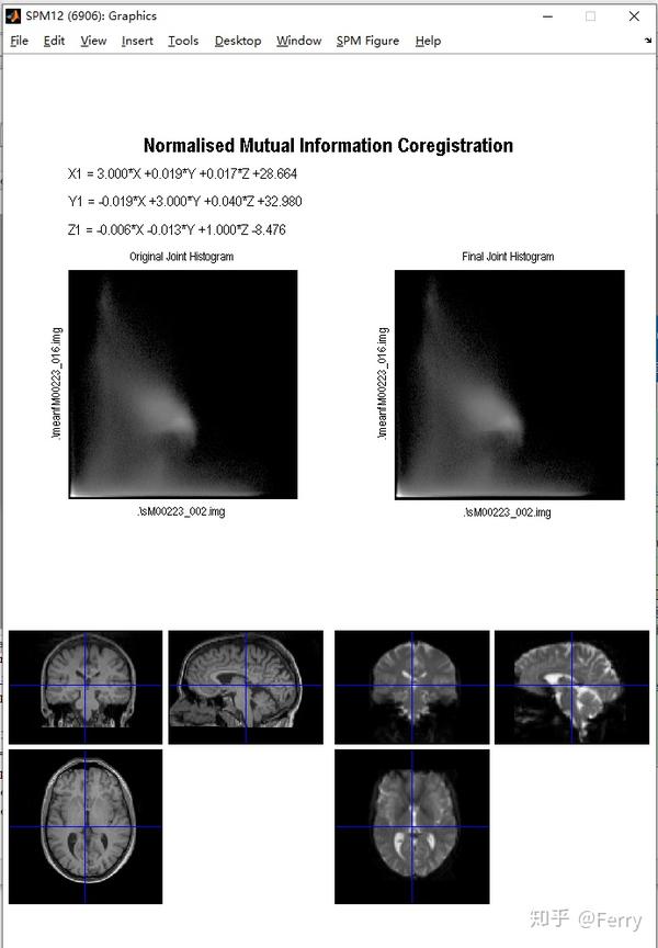 Fmri静息态功能性核磁共振预处理图解 知乎 2452