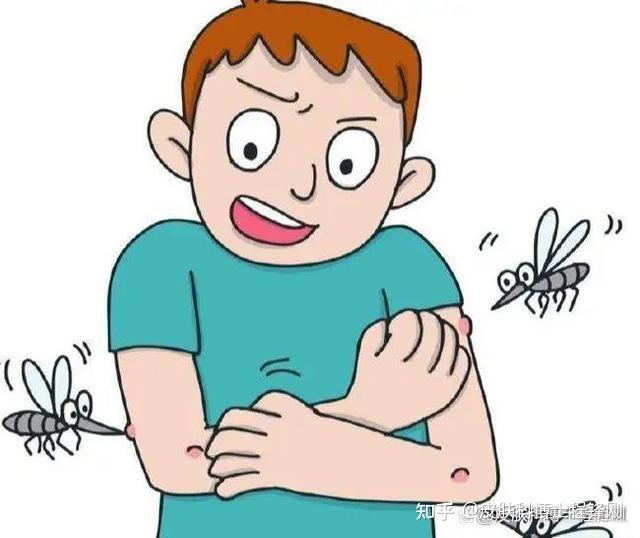 蚊虫叮咬后,如何快速止痒、防搔抓、防留疤? - 知乎