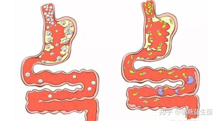 益生菌是怎麼幹掉有害菌的? - 知乎