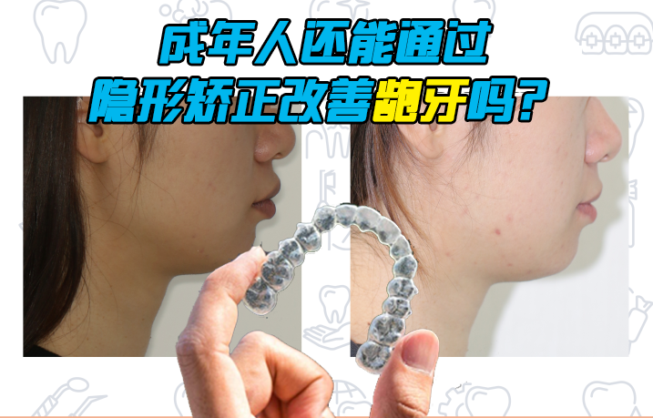 v2-095a53f3417ce6c62d42325566e5991a_1440w.jpg?source=172ae18b