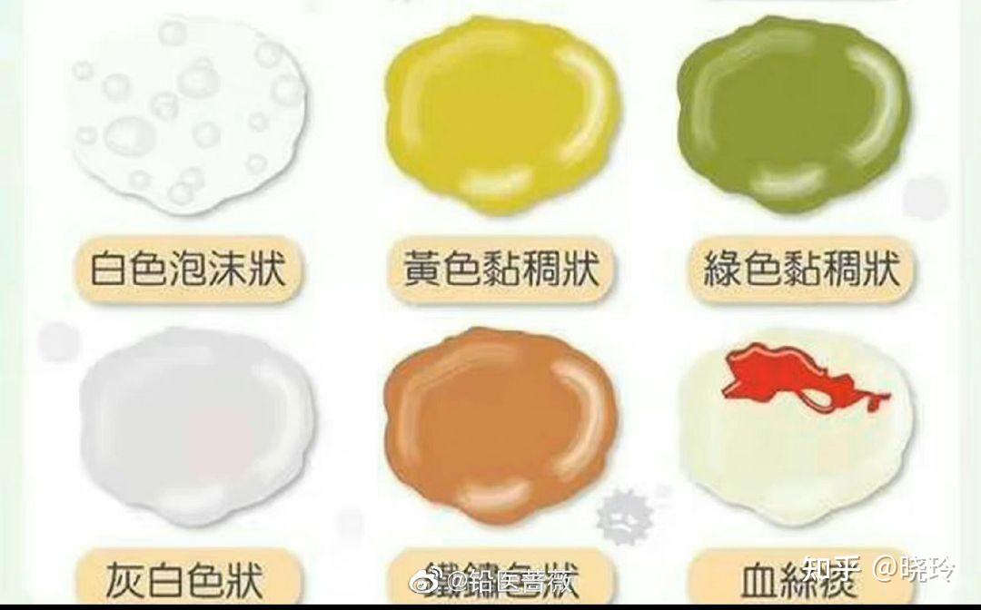 咳出白痰和黄痰有什么区别 - 知乎