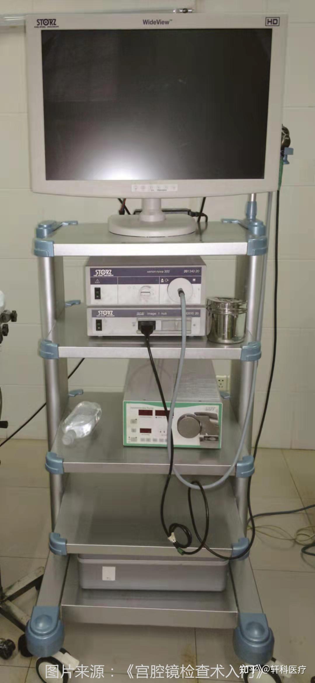 你知道什么是宫腔镜吗?