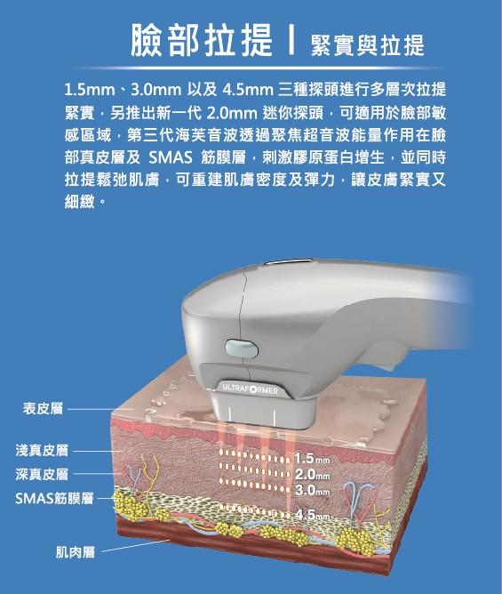 第三代hifu超声刀 (海扶刀)|群英整形医美