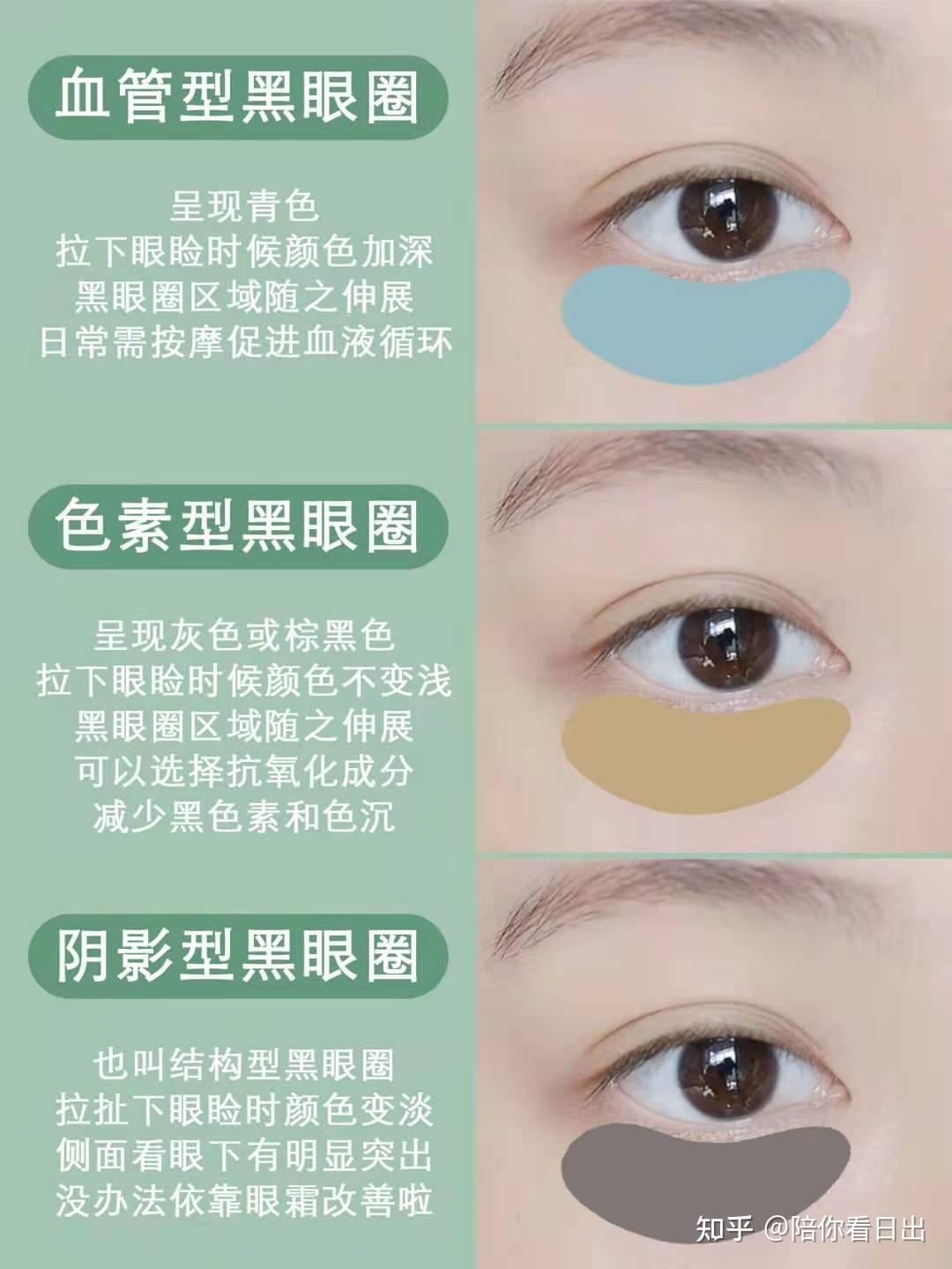 黑眼圈颜色对照图图片