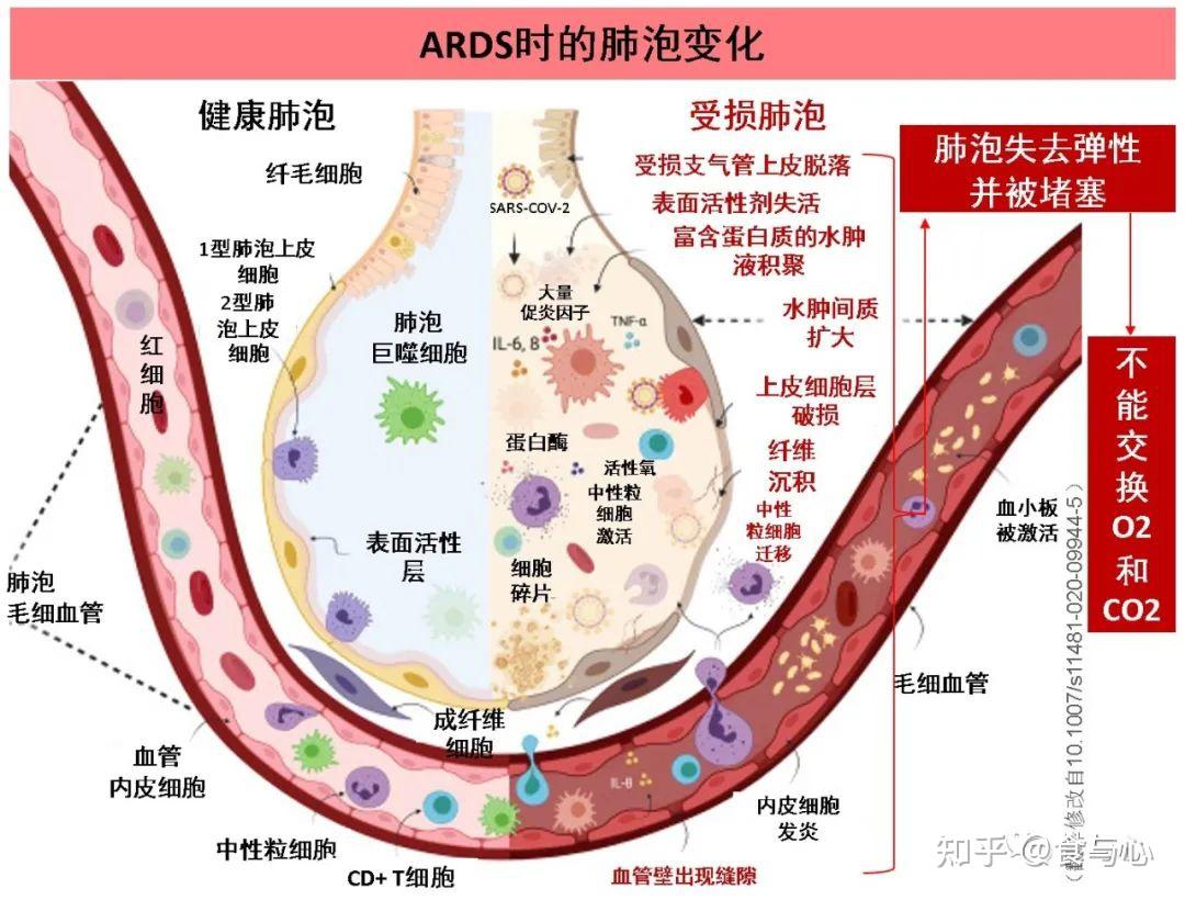 图文了解人体与甲流和新冠病毒的战争1：i型干扰素反应是关键 知乎 
