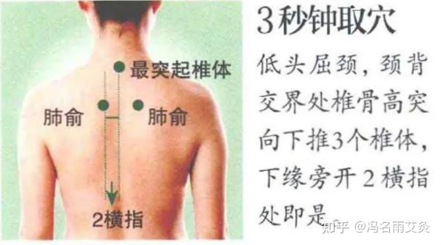 了解体内水液循环,穴位艾灸,解决下肢水肿 - 知乎